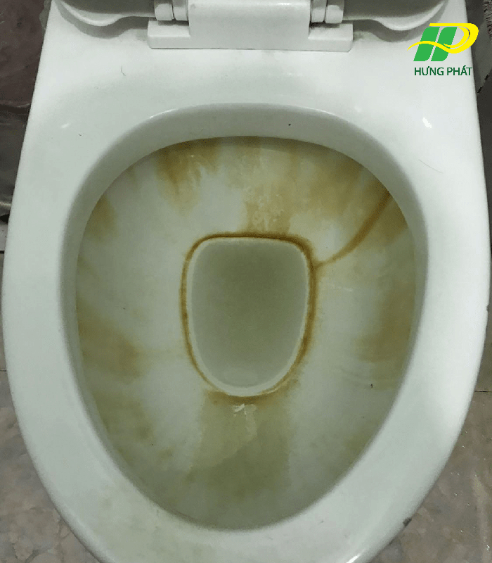Bồn cầu bị ố vàng hiệu gây mất thẩm mỹ 